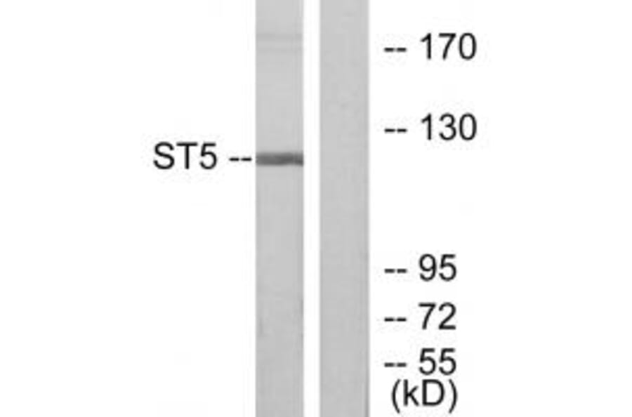 Western blot - ST5 Antibody from Signalway Antibody (33837) - Antibodies.com
