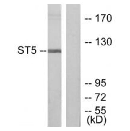 Western blot - ST5 Antibody from Signalway Antibody (33837) - Antibodies.com