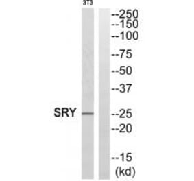 Western blot - SRY Antibody from Signalway Antibody (33859) - Antibodies.com