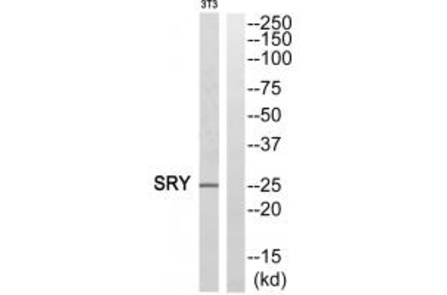 Western blot - SRY Antibody from Signalway Antibody (33859) - Antibodies.com