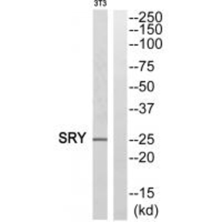 Western blot - SRY Antibody from Signalway Antibody (33859) - Antibodies.com