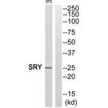 Western blot - SRY Antibody from Signalway Antibody (33859) - Antibodies.com