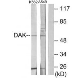 Western blot - DAK Antibody from Signalway Antibody (33920) - Antibodies.com