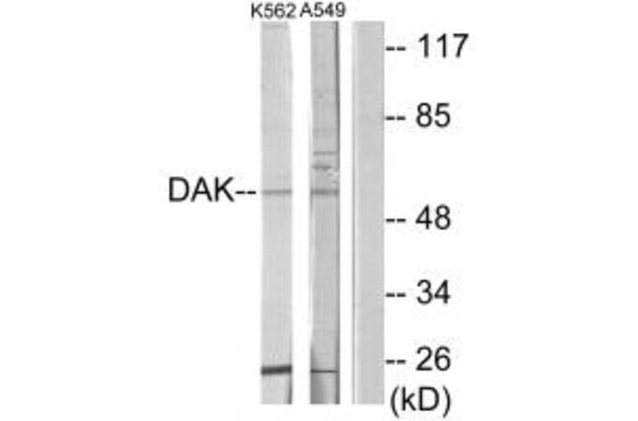 Western blot - DAK Antibody from Signalway Antibody (33920) - Antibodies.com