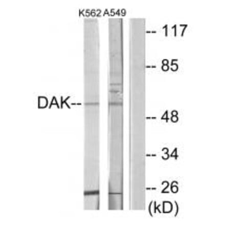 Western blot - DAK Antibody from Signalway Antibody (33920) - Antibodies.com