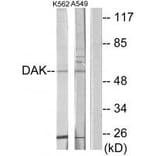 Western blot - DAK Antibody from Signalway Antibody (33920) - Antibodies.com