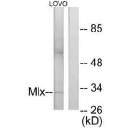 Western blot - Mlx Antibody from Signalway Antibody (34102) - Antibodies.com