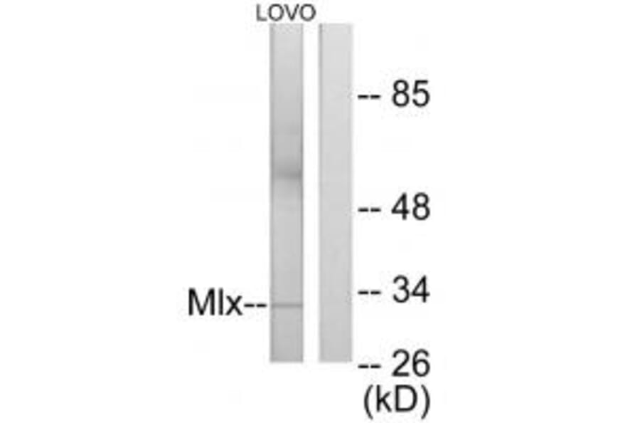 Western blot - Mlx Antibody from Signalway Antibody (34102) - Antibodies.com