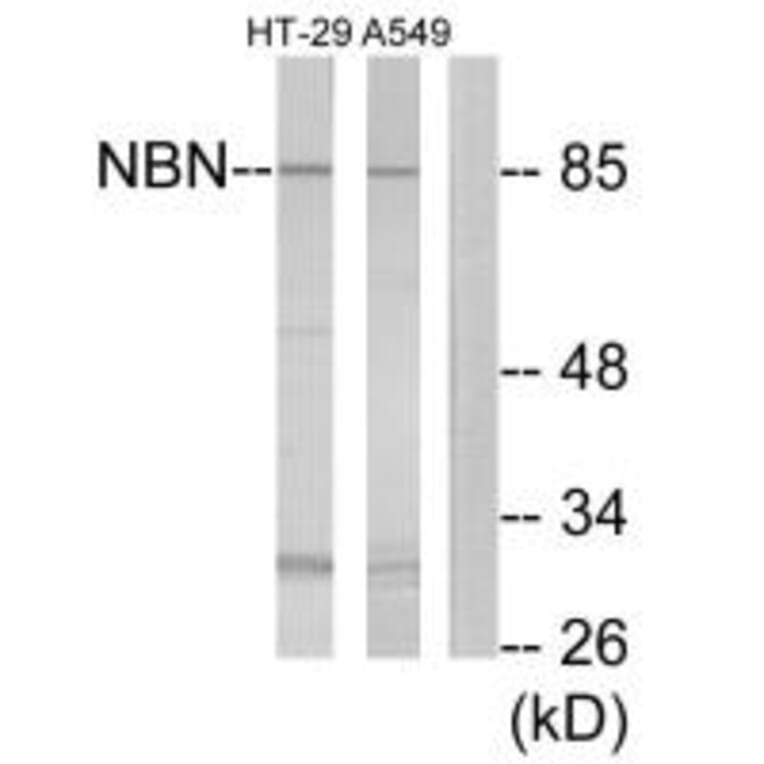 Western blot - NBN Antibody from Signalway Antibody (34291) - Antibodies.com