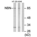 Western blot - NBN Antibody from Signalway Antibody (34291) - Antibodies.com