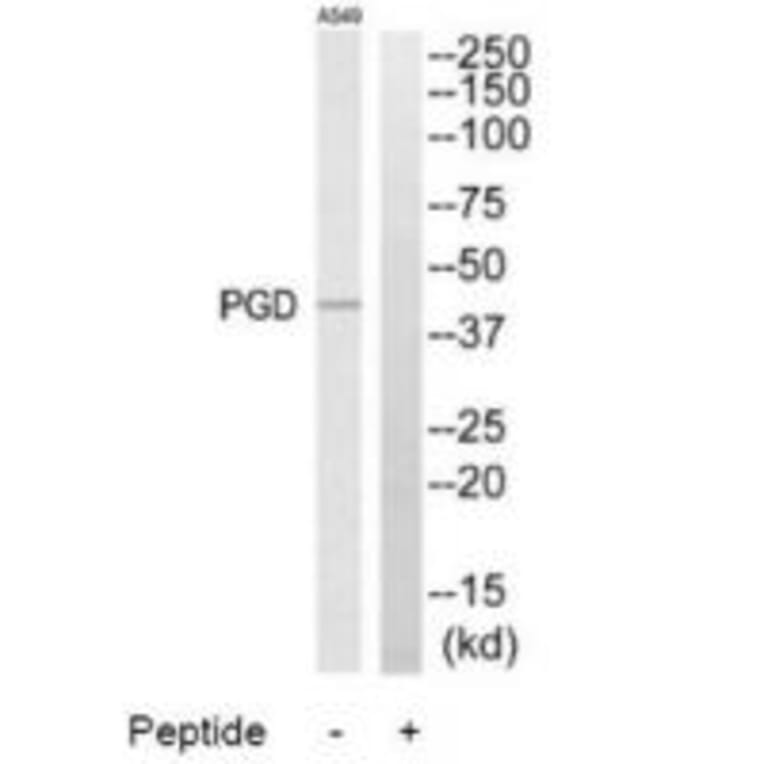 Western blot - PGD Antibody from Signalway Antibody (34364) - Antibodies.com