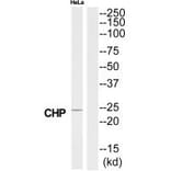 Western blot - CHP Antibody from Signalway Antibody (34517) - Antibodies.com