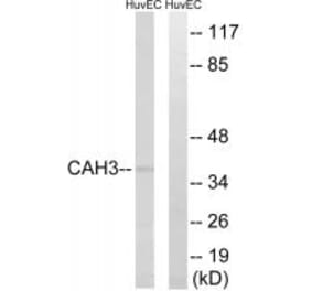 Western blot - CA3 Antibody from Signalway Antibody (34540) - Antibodies.com