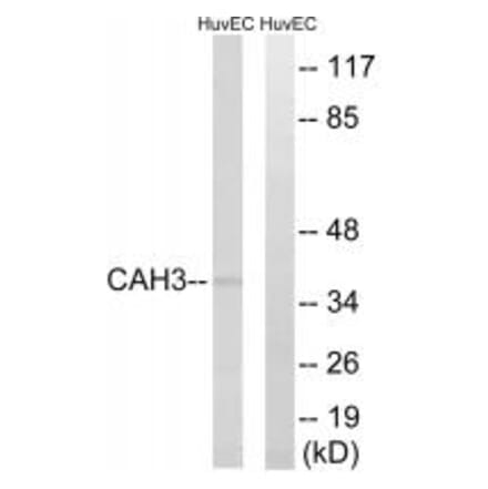 Western blot - CA3 Antibody from Signalway Antibody (34540) - Antibodies.com