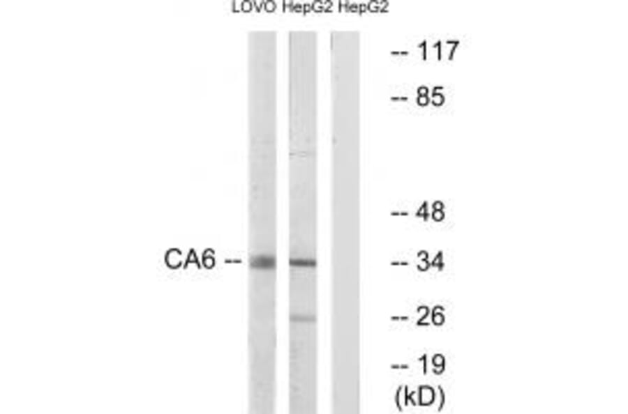 Western blot - CA6 Antibody from Signalway Antibody (34543) - Antibodies.com