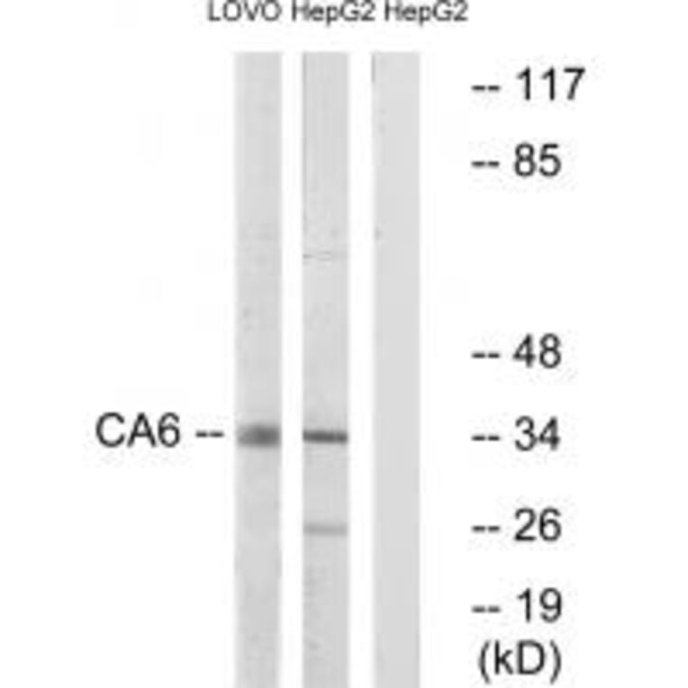 Western blot - CA6 Antibody from Signalway Antibody (34543) - Antibodies.com