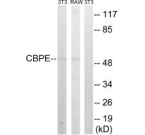 Western blot - CPE Antibody from Signalway Antibody (34548) - Antibodies.com