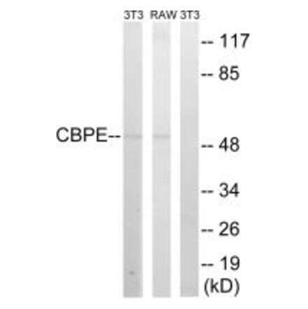 Western blot - CPE Antibody from Signalway Antibody (34548) - Antibodies.com