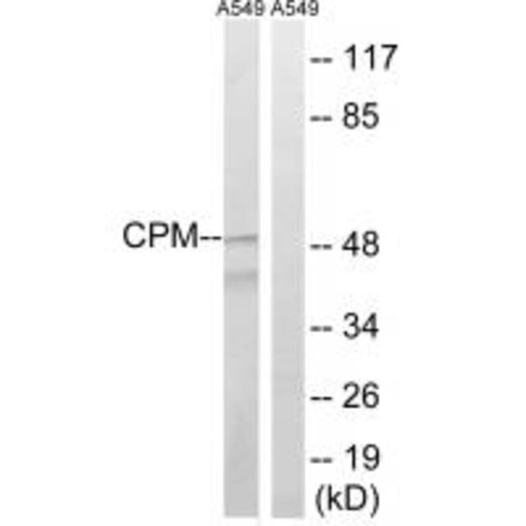 Western blot - CPM Antibody from Signalway Antibody (34549) - Antibodies.com