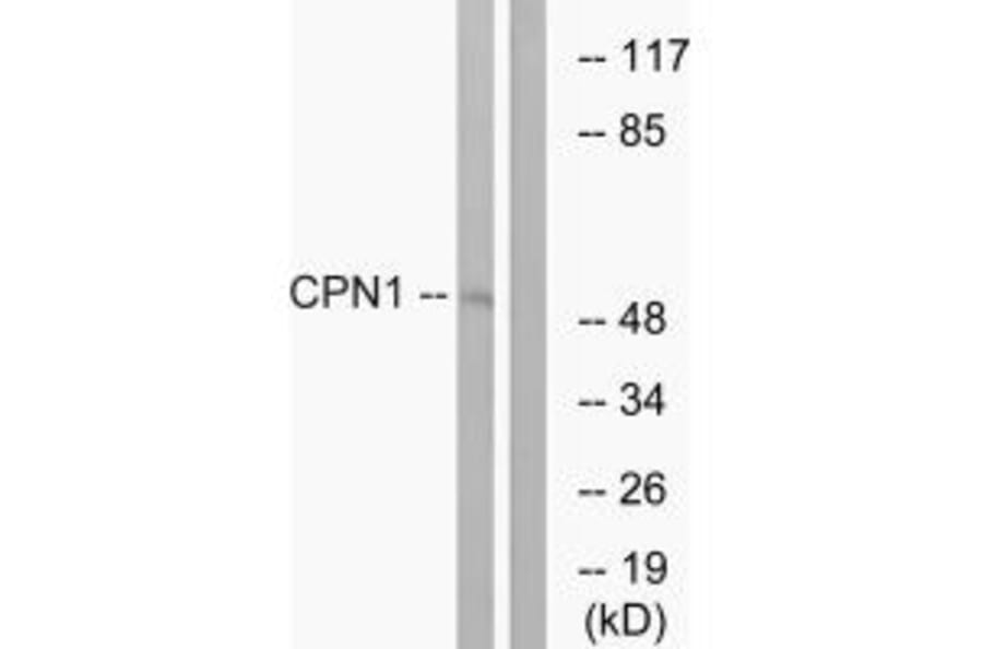 Western blot - CPN1 Antibod from Signalway Antibody (34550) - Antibodies.com