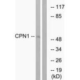 Western blot - CPN1 Antibod from Signalway Antibody (34550) - Antibodies.com