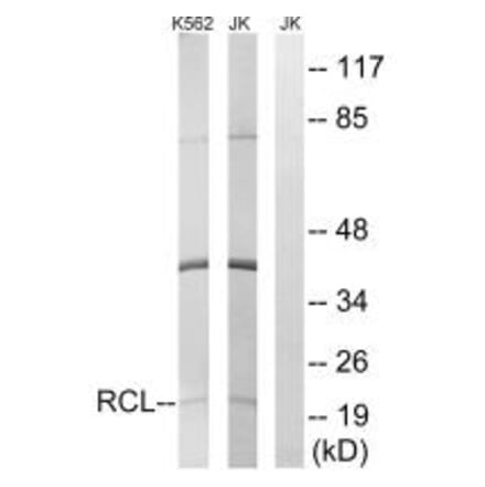 Western blot - RCL Antibody from Signalway Antibody (34602) - Antibodies.com