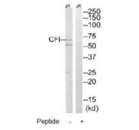Western blot - CFI Antibody from Signalway Antibody (34614) - Antibodies.com