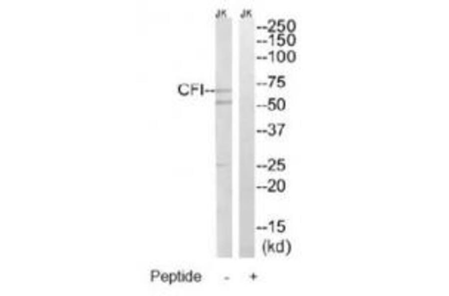 Western blot - CFI Antibody from Signalway Antibody (34614) - Antibodies.com