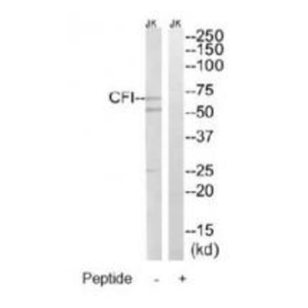 Western blot - CFI Antibody from Signalway Antibody (34614) - Antibodies.com