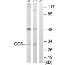 Western blot - CCS Antibody from Signalway Antibody (34622) - Antibodies.com
