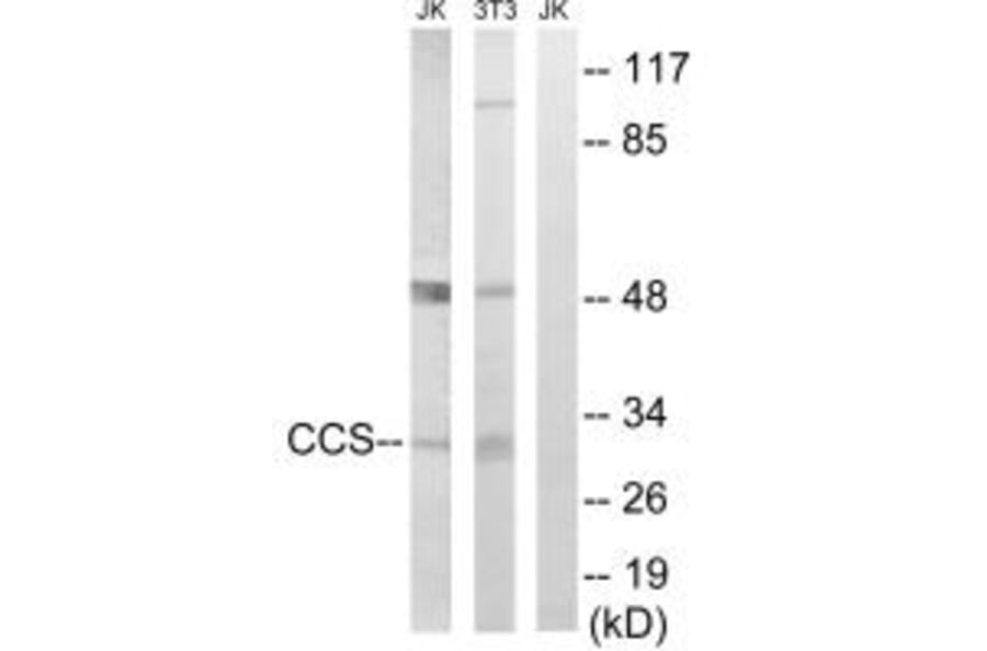 Western blot - CCS Antibody from Signalway Antibody (34622) - Antibodies.com