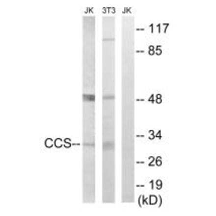 Western blot - CCS Antibody from Signalway Antibody (34622) - Antibodies.com