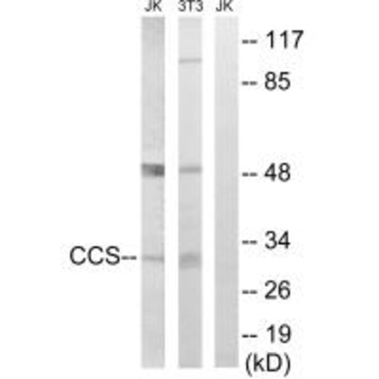 Western blot - CCS Antibody from Signalway Antibody (34622) - Antibodies.com