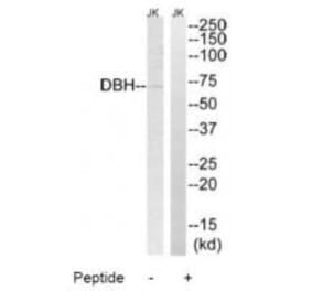 Western blot - DBH Antibody from Signalway Antibody (34658) - Antibodies.com