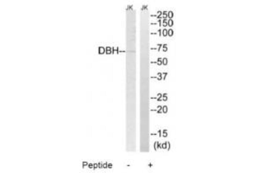 Western blot - DBH Antibody from Signalway Antibody (34658) - Antibodies.com