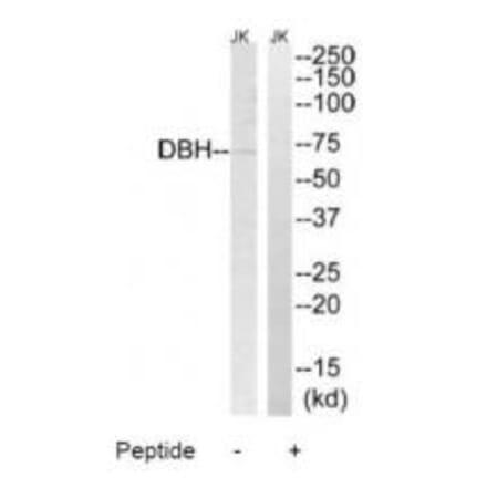 Western blot - DBH Antibody from Signalway Antibody (34658) - Antibodies.com