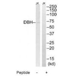 Western blot - DBH Antibody from Signalway Antibody (34658) - Antibodies.com
