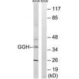Western blot - GGH Antibody from Signalway Antibody (34695) - Antibodies.com