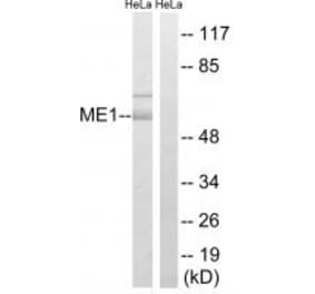 Western blot - ME1 Antibody from Signalway Antibody (34842) - Antibodies.com