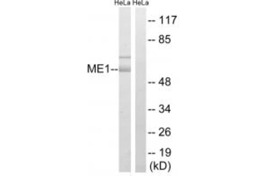 Western blot - ME1 Antibody from Signalway Antibody (34842) - Antibodies.com