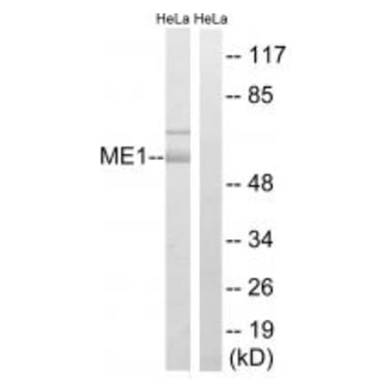 Western blot - ME1 Antibody from Signalway Antibody (34842) - Antibodies.com