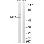 Western blot - ME1 Antibody from Signalway Antibody (34842) - Antibodies.com