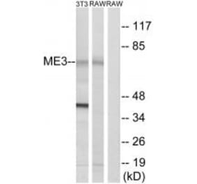 Western blot - ME3 Antibody from Signalway Antibody (34843) - Antibodies.com