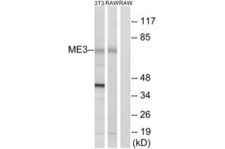 Western blot - ME3 Antibody from Signalway Antibody (34843) - Antibodies.com