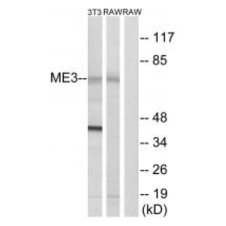 Western blot - ME3 Antibody from Signalway Antibody (34843) - Antibodies.com