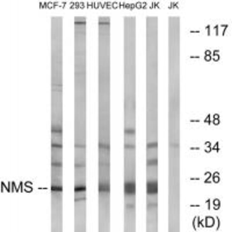 Western blot - NMS Antibody from Signalway Antibody (34856) - Antibodies.com