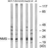 Western blot - NMS Antibody from Signalway Antibody (34856) - Antibodies.com