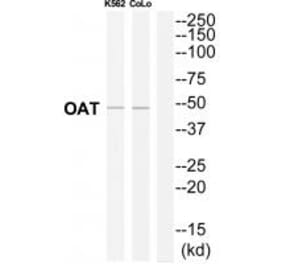 Western blot - OAT Antibody from Signalway Antibody (34882) - Antibodies.com