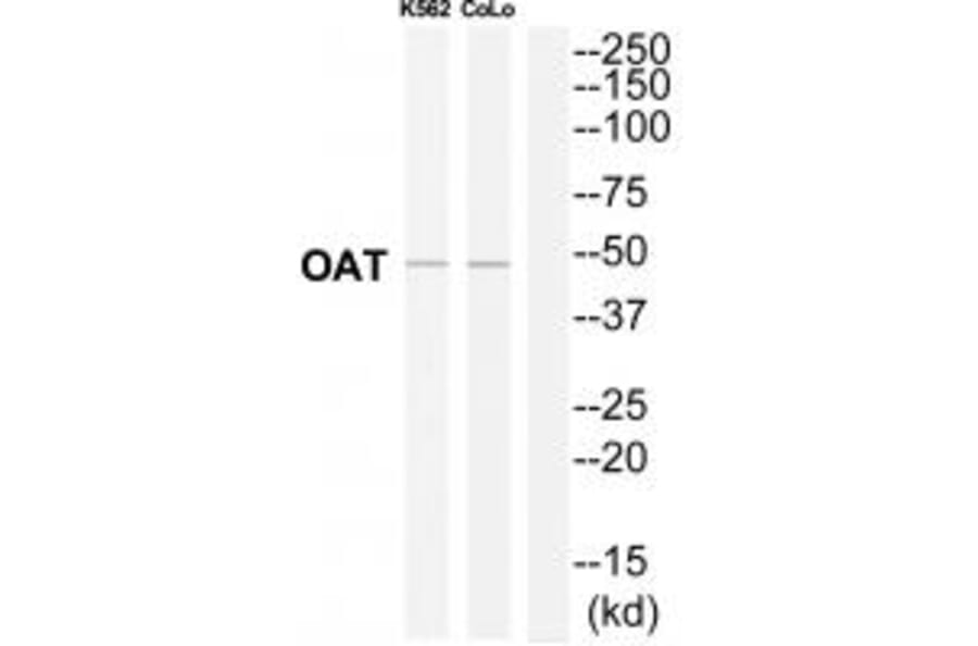 Western blot - OAT Antibody from Signalway Antibody (34882) - Antibodies.com