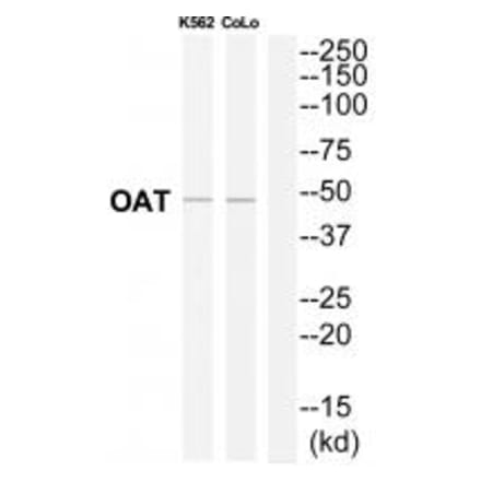 Western blot - OAT Antibody from Signalway Antibody (34882) - Antibodies.com